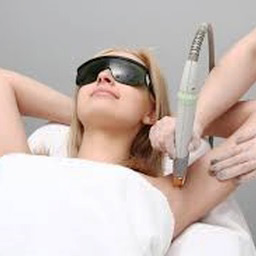 laser hair removal