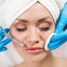 Dermal Filler