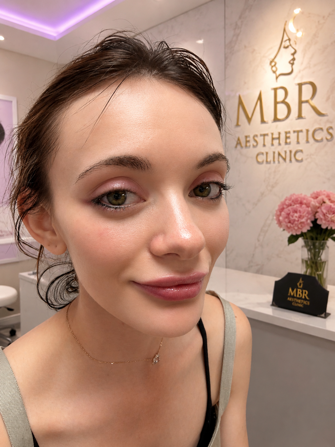Russian Lip Filler