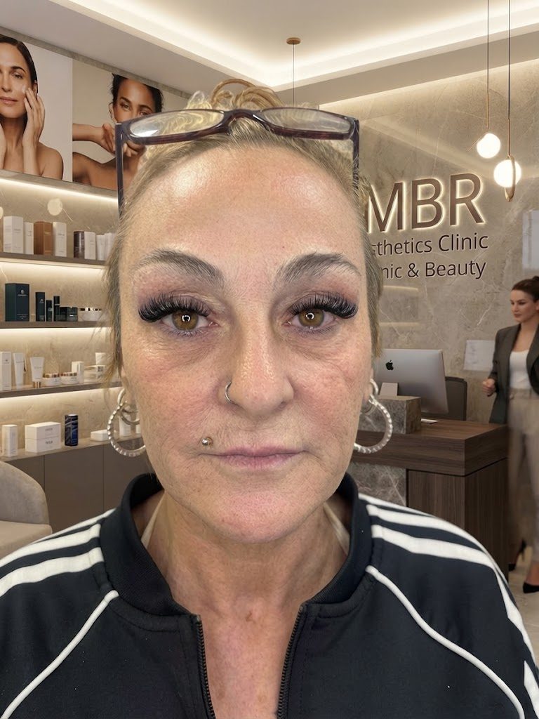 After treatment result