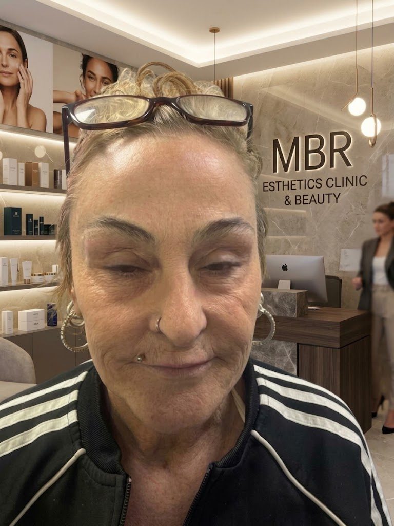 Before treatment